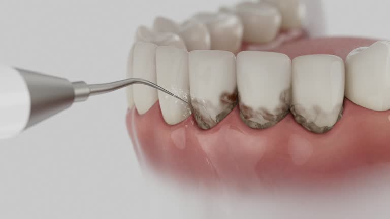 Reliable Emergency Dentist contractor in Escondido, CA by Smile Center Dentistry
